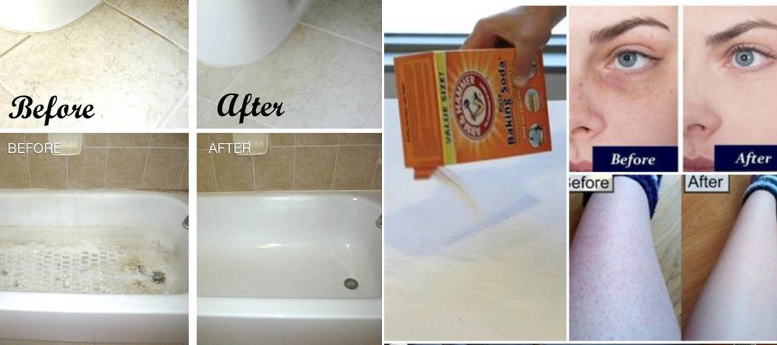 9 Κόλπα με Μαγειρική Σόδα που Πρέπει να Ξέρετε