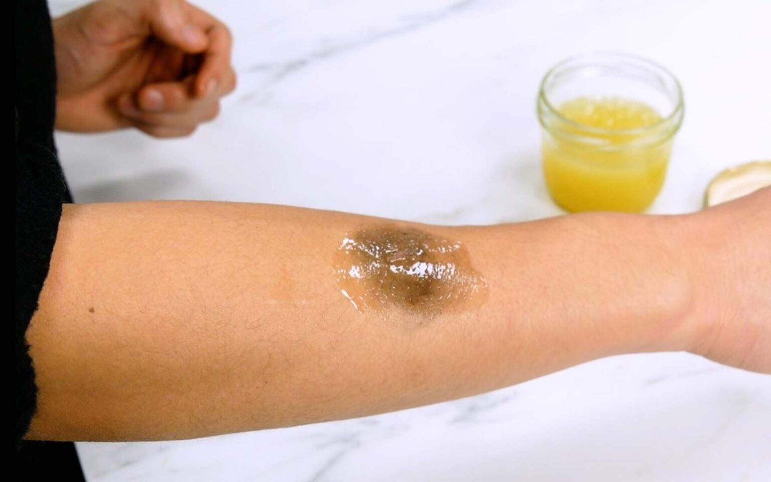 6 Σπιτικές Θεραπείες που θα σας Ανακουφίσουν