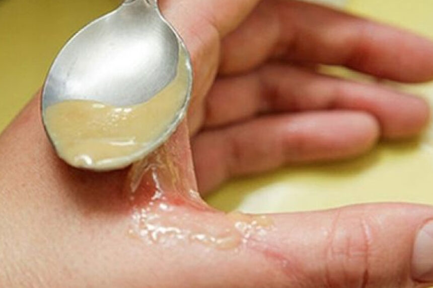 χρήσεις μελιού