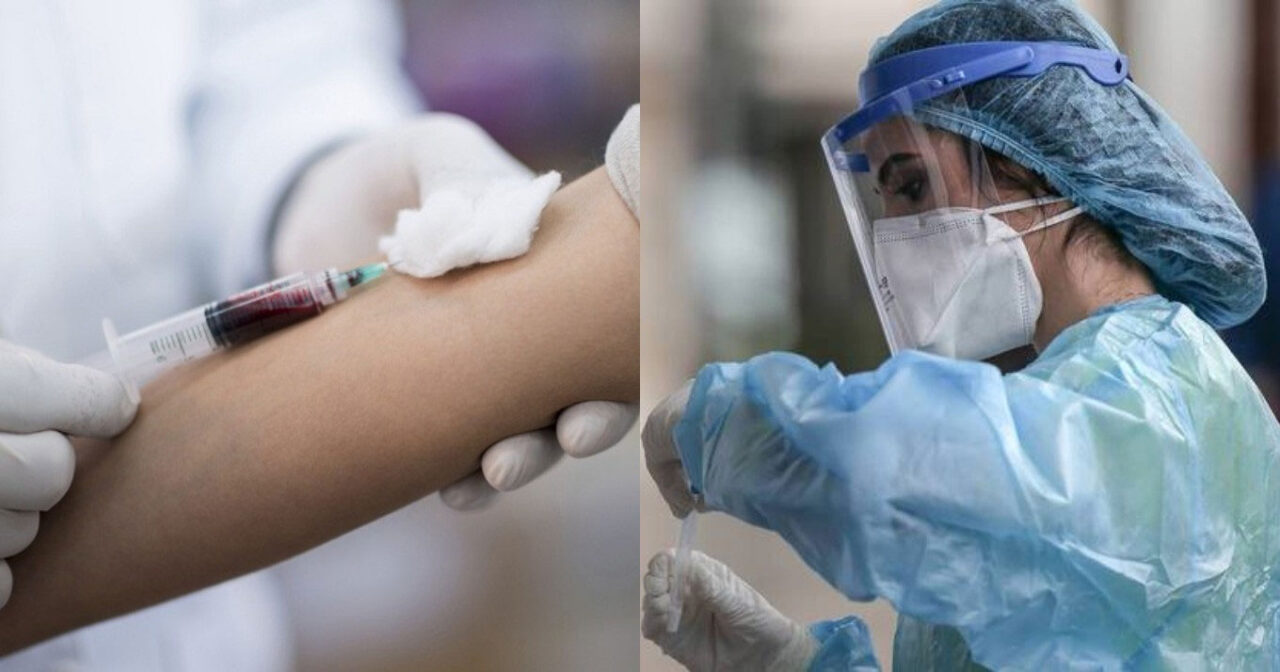 Αυτό δεν μας το είπε κανείς: Η εξέταση που επιβάλλεται να κάνουν, ένα χρόνο μετά, όσοι κόλλησαν κορωνοϊό