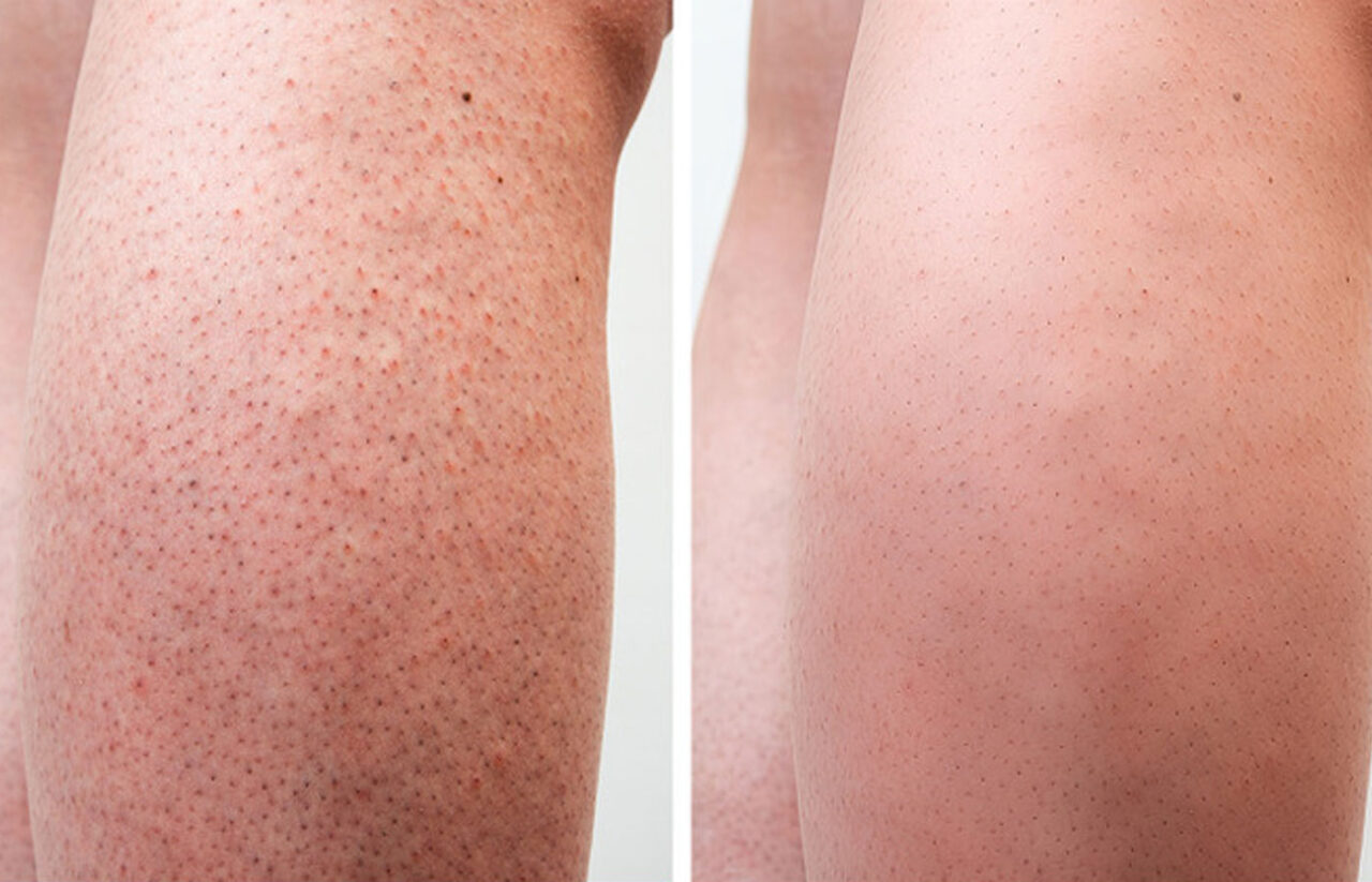 8 Συμβουλές Ομορφιάς που Μπορεί να Έχετε Δοκιμάσει και Είναι Βλαβερές