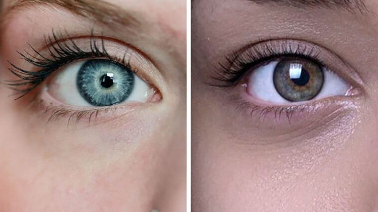 Γιατί οι Άνθρωποι με Μπλε Μάτια Είναι Τόσο Μοναδικοί