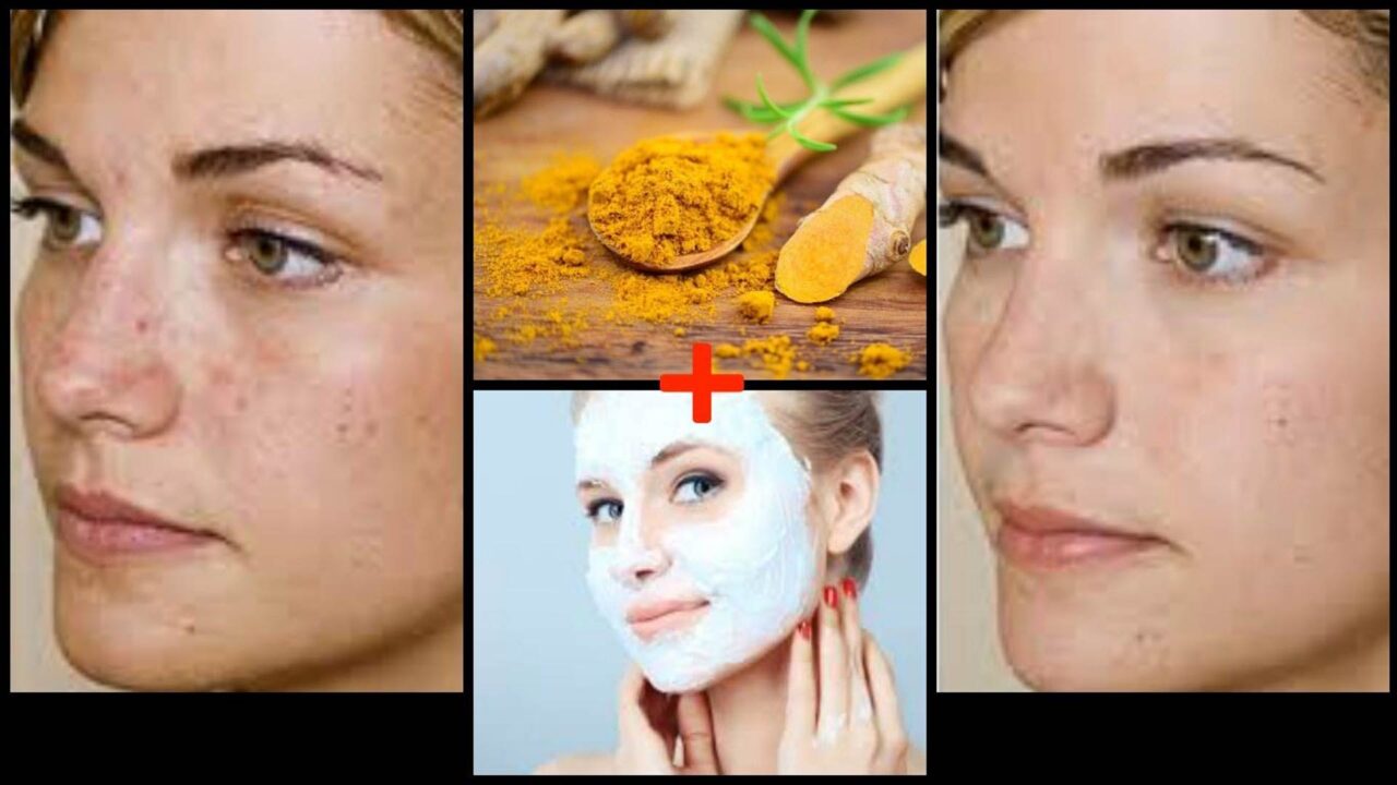 7 Οφέλη του Κουρκουμά για το Δέρμα και πώς να το Χρησιμοποιήσετε