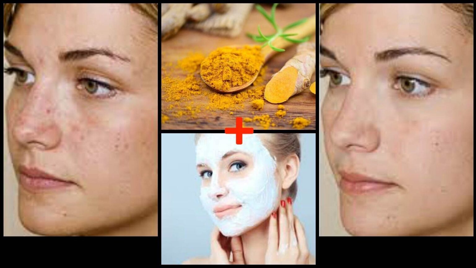 7 Οφέλη του Κουρκουμά για το Δέρμα και πώς να το Χρησιμοποιήσετε