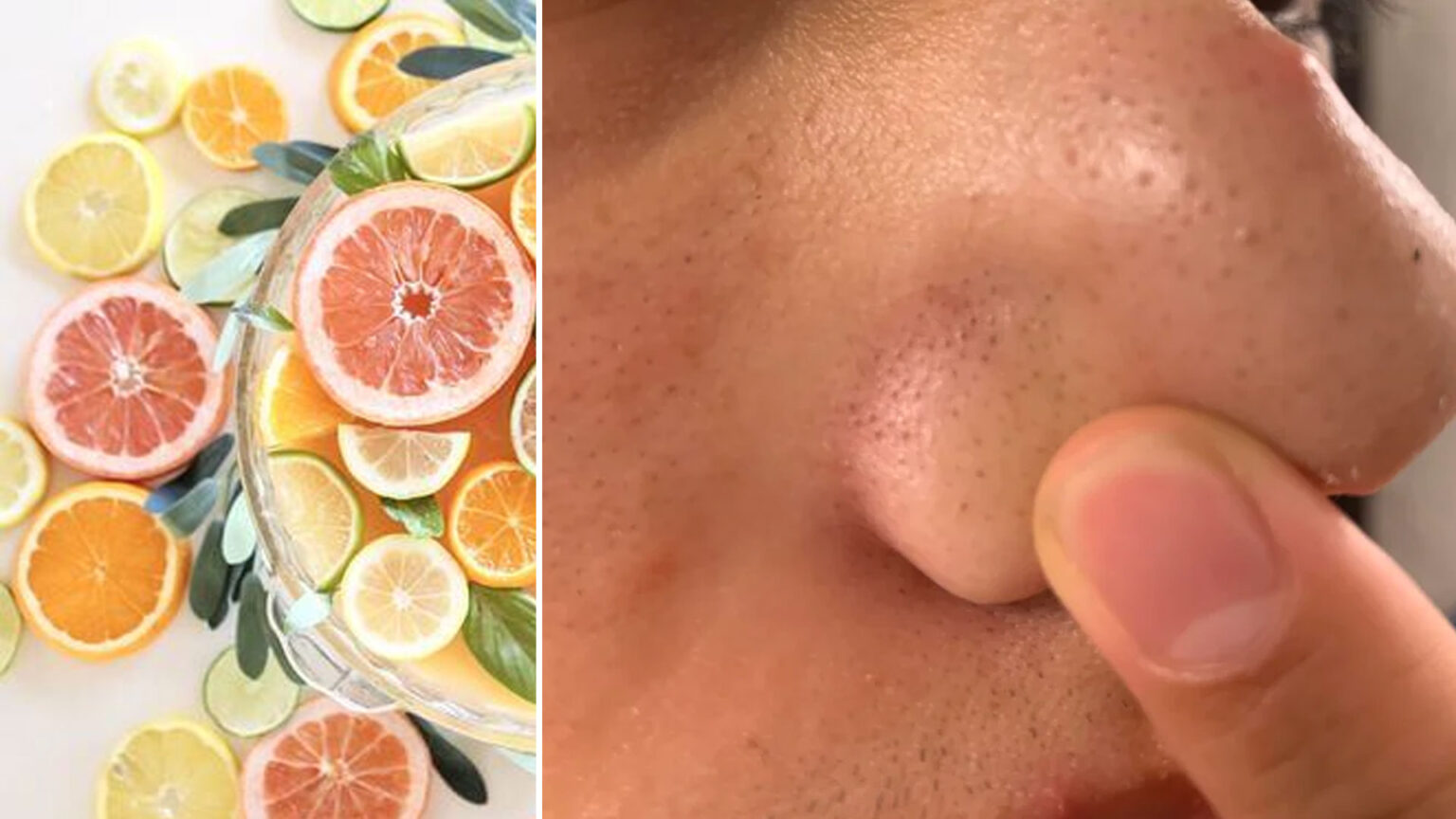 αιθέρια έλαια για μαύρα στίγματα,αντιμετώπιση μαύρων στιγμάτων,φροντίδα προσώπου,συμβουλές ομορφιάς,ομορφιά,