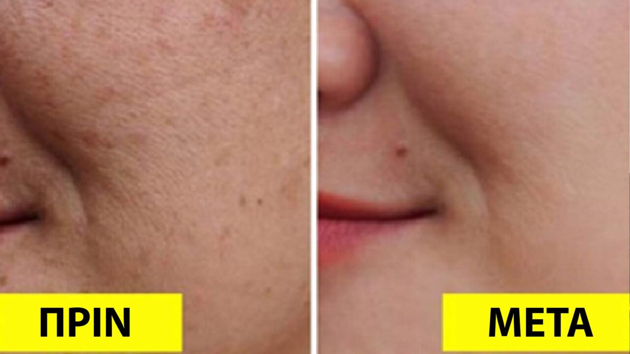 φροντίδα δέρματος,αναζωογόνηση δέρματος,συμβουλές ομορφιάς,ομορφιά,