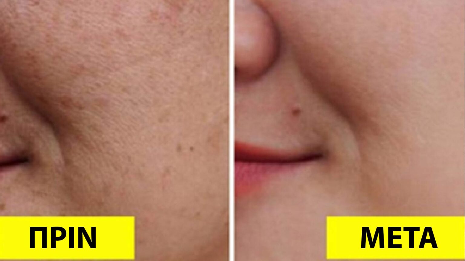 φροντίδα δέρματος,αναζωογόνηση δέρματος,συμβουλές ομορφιάς,ομορφιά,