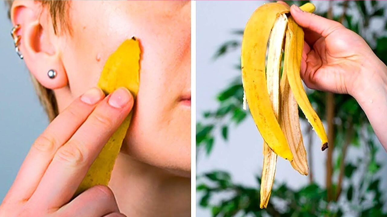 DIY μάσκα προσώπου με μπανανόφλουδα,μασάζ προσώπου με μπανανόφλουδα,αφαίρεση μαύρων κηλίδων,αντιμετώπιση ακμής,φροντίδα δέρματος,συμβουλές ομορφιάς,ομορφιά,