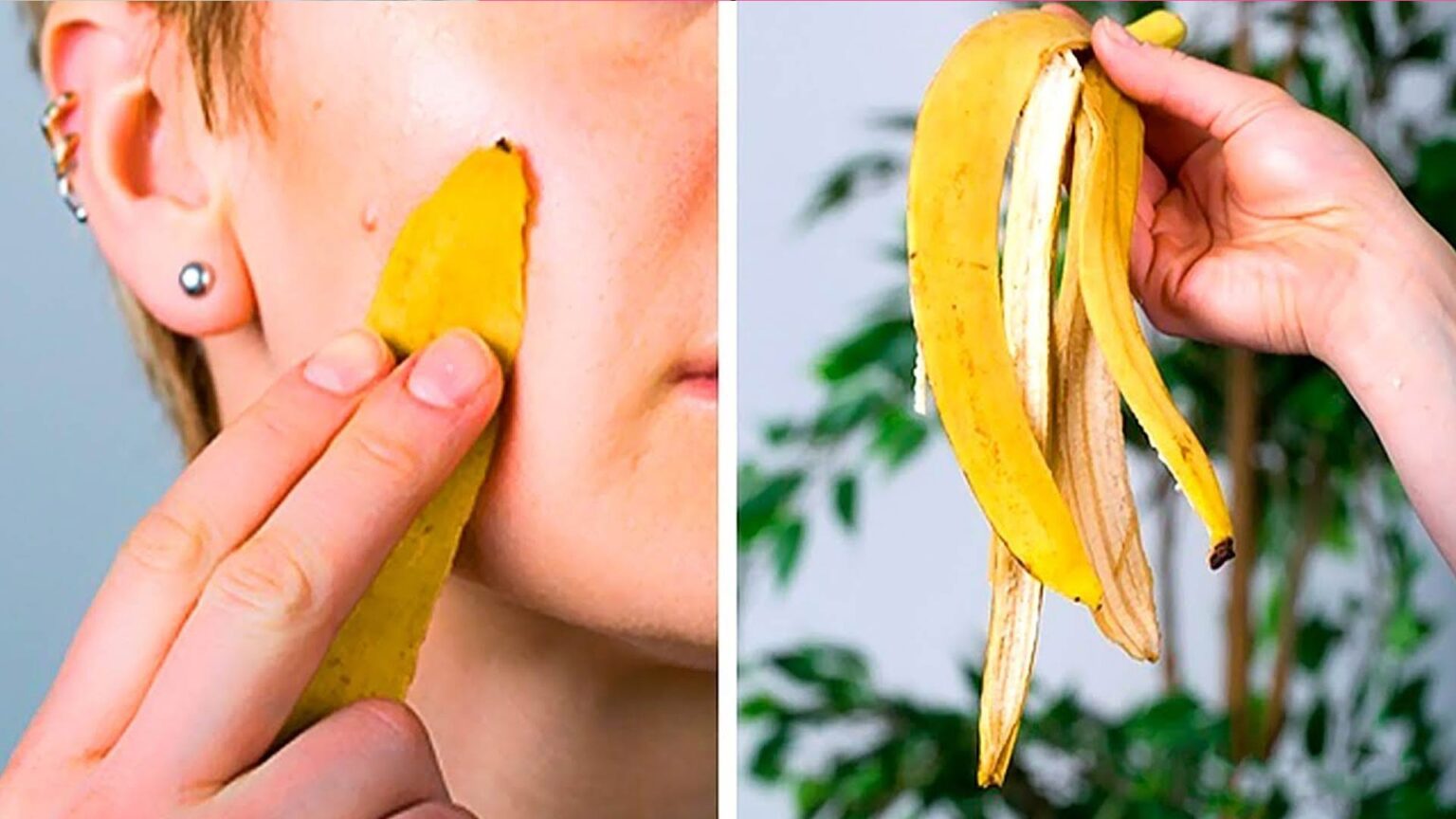 DIY μάσκα προσώπου με μπανανόφλουδα,μασάζ προσώπου με μπανανόφλουδα,αφαίρεση μαύρων κηλίδων,αντιμετώπιση ακμής,φροντίδα δέρματος,συμβουλές ομορφιάς,ομορφιά,