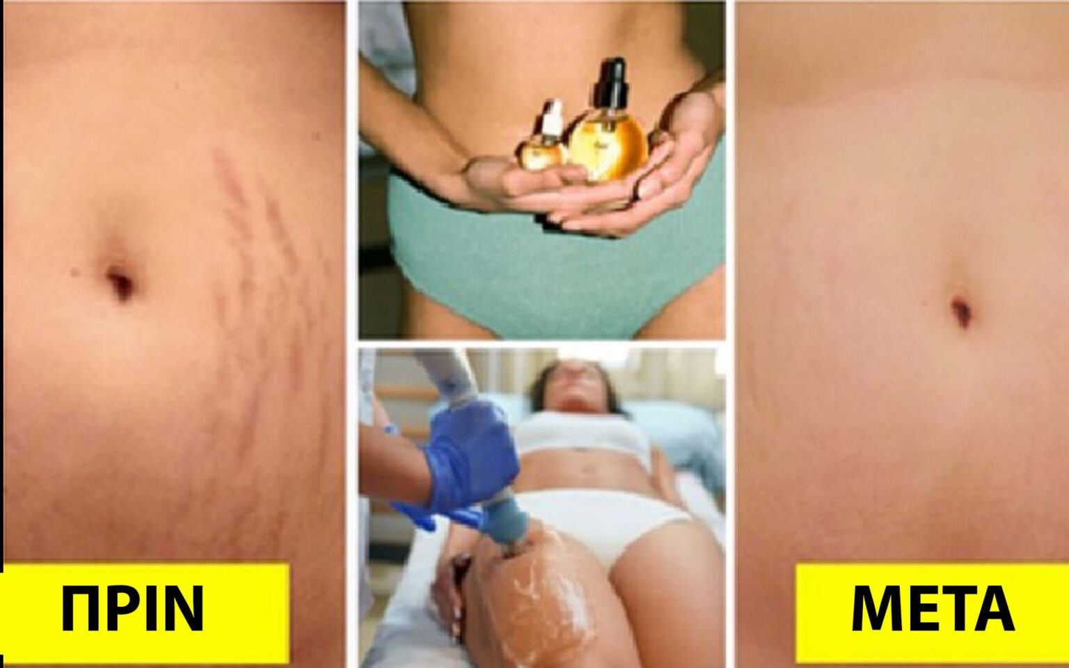 5 Τρόποι για να Απαλλαγείτε από τις Ραγάδες με Επαγγελματικό Στυλ