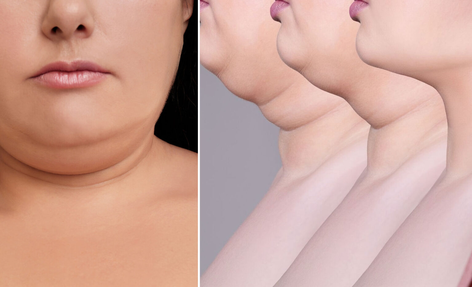 διπλό πηγούνι,διπλοσάγονο,συμβουλές ομορφιάς,ομορφιά,