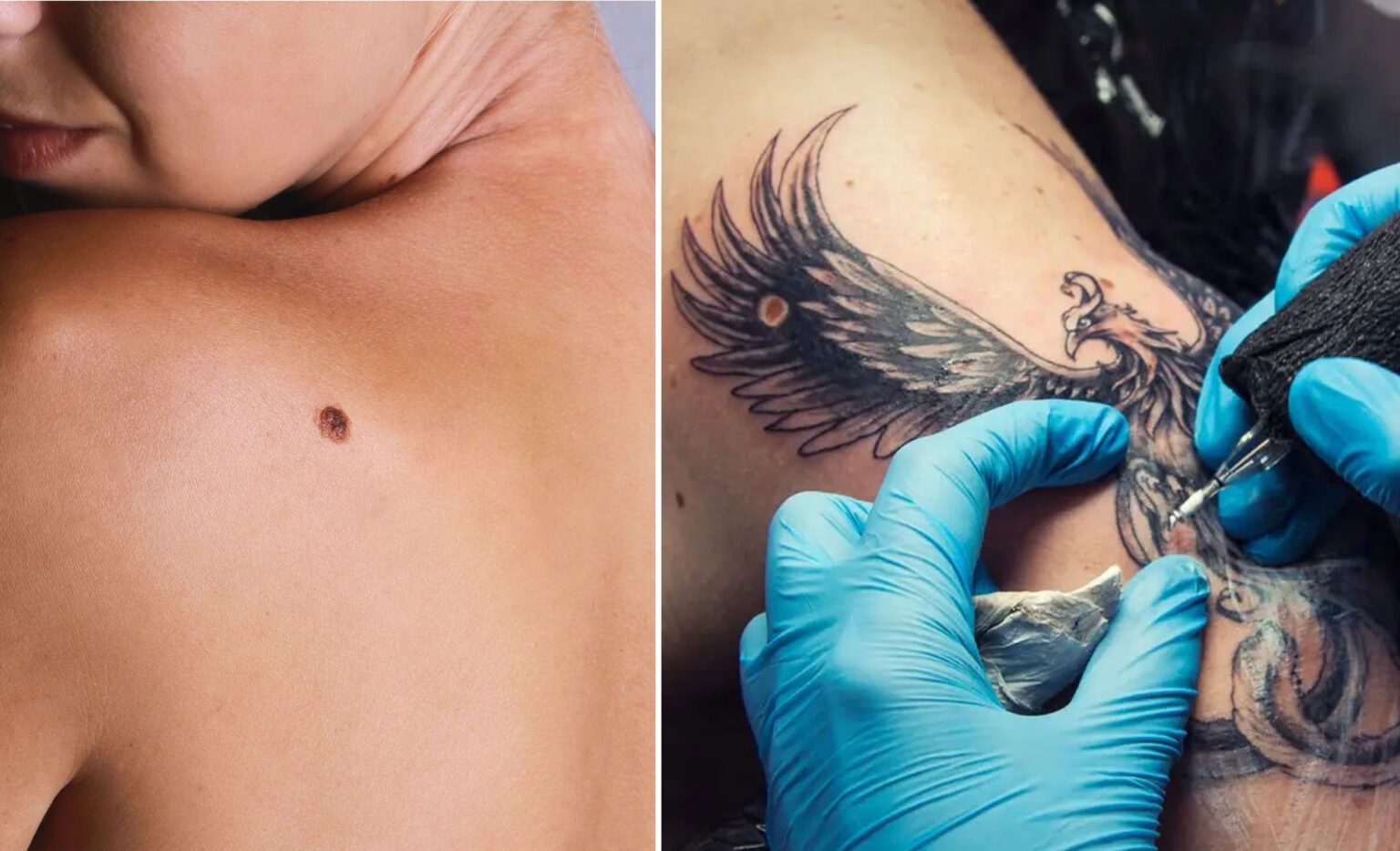 τατουάζ σε ελιές,καρκίνος του δέρματος,συμβουλές για τατουάζ,υγεία,συμβουλές υγείας,