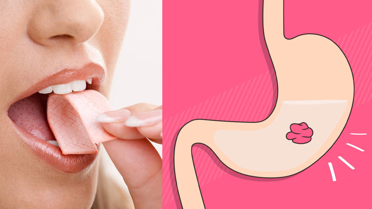 Τι Παθαίνεις Αν Καταπιείς Τσίχλα: Πόσες Πρέπει Να Τρως Ημερησίως Και Από Ποια Ηλικία Επιτρέπεται στα Παιδιά