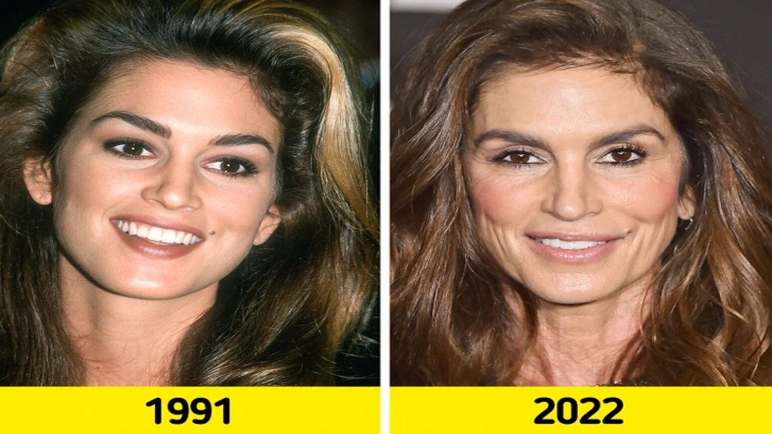 Το Πριν Και Το Μετά: Πώς Έχουν Αλλάξει 18 Μοντέλα που Κατέκτησαν τον Κόσμο με την Ομορφιά τους