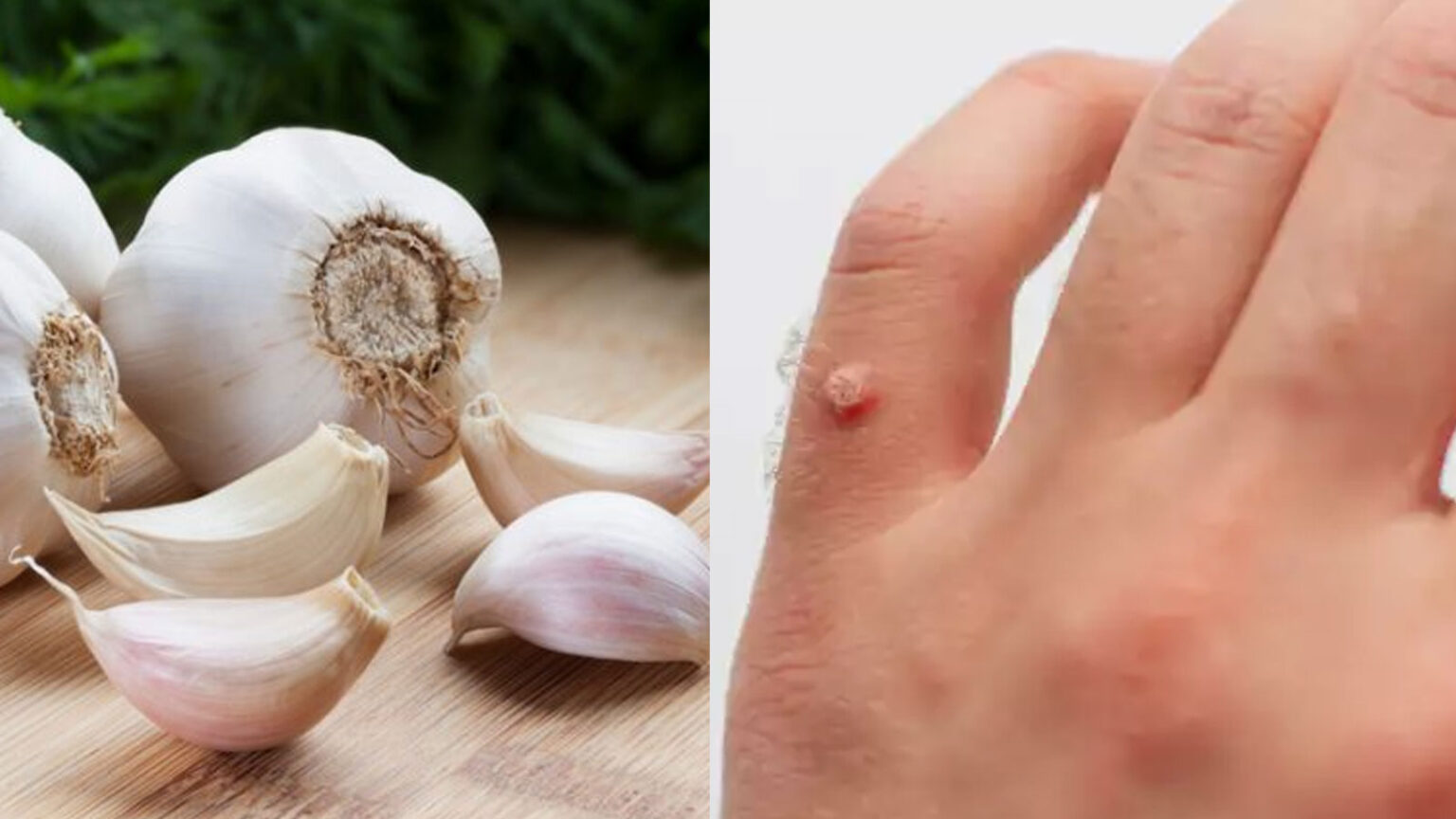 Το Σκόρδο Αφαιρεί το 100% των Μυρμηγκιών σε Κλινική Μελέτη