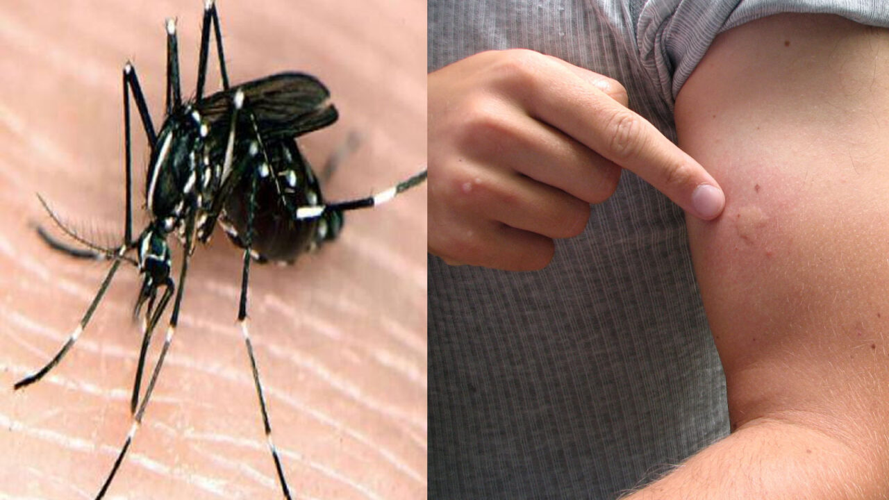 κουνούπια,αντιμετώπιση κουνουπιών,σπιτικό αντικουνουπικό,εντομοαπωθητικά φυτά,συμβουλές,χρήσιμα,