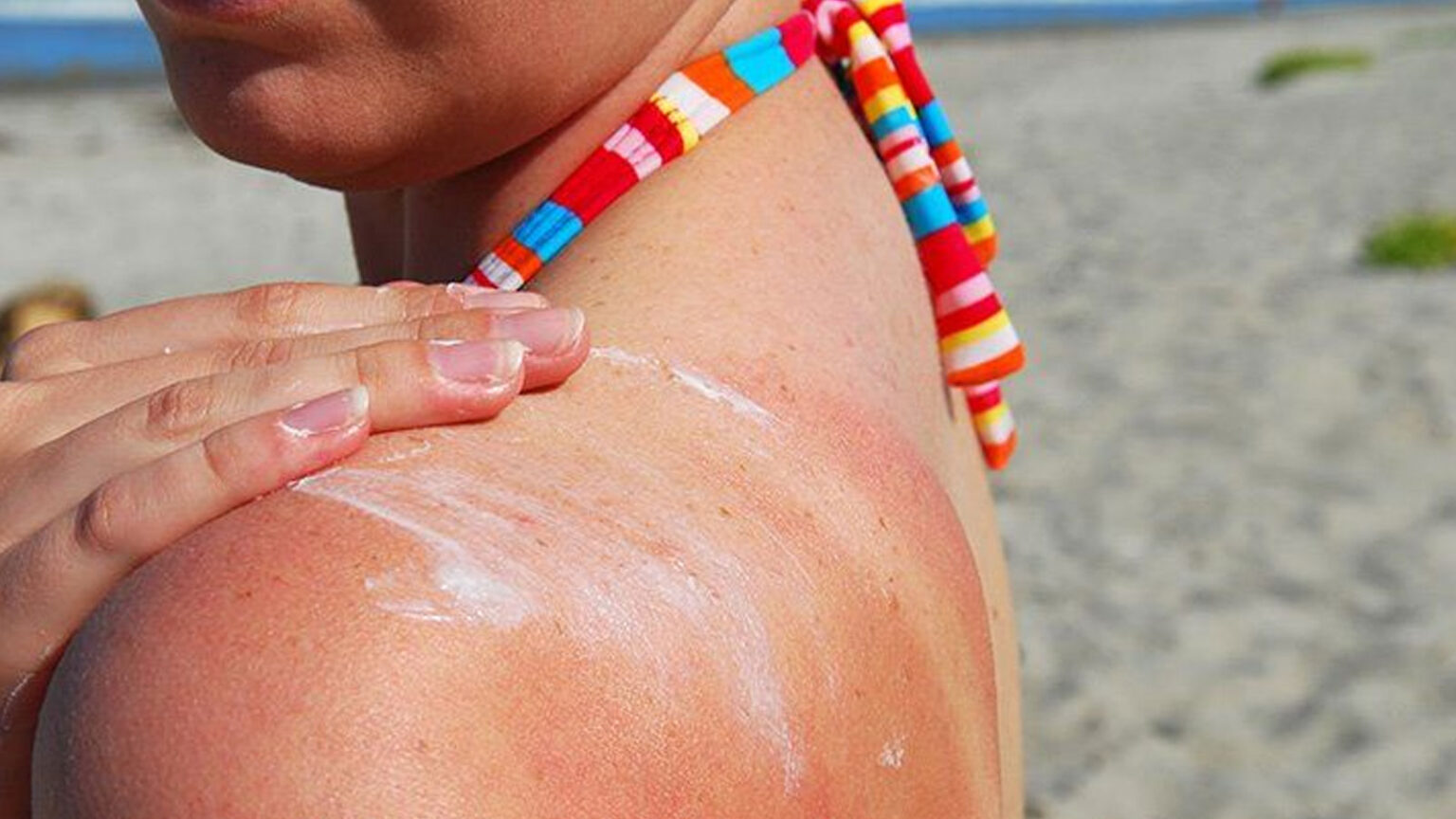 Μην Αφήνεις Το Αντηλιακό Στον Ήλιο: Τι Μπορεί Να Συμβεί