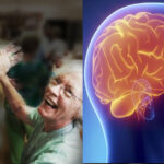 Γήρανση Εγκέφαλου: Ο Χορός Μπορεί να την Αντιστρέψει