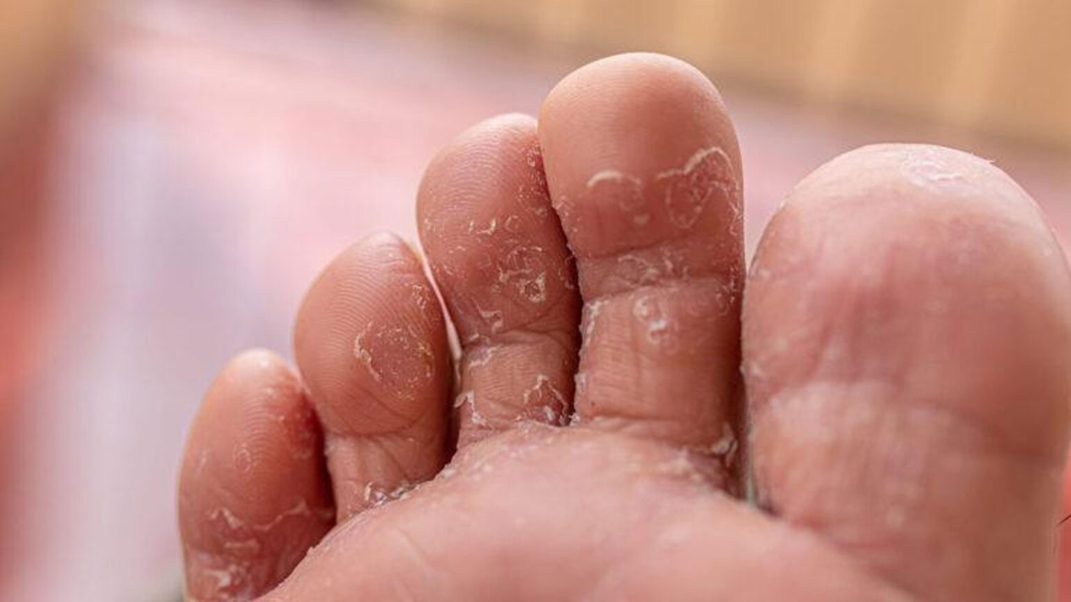 ΠΡΟΣΟΧΗ Στην Άμμο Και Τις Πετσέτες: Αυτά Μπορεί Να Κολλήσεις