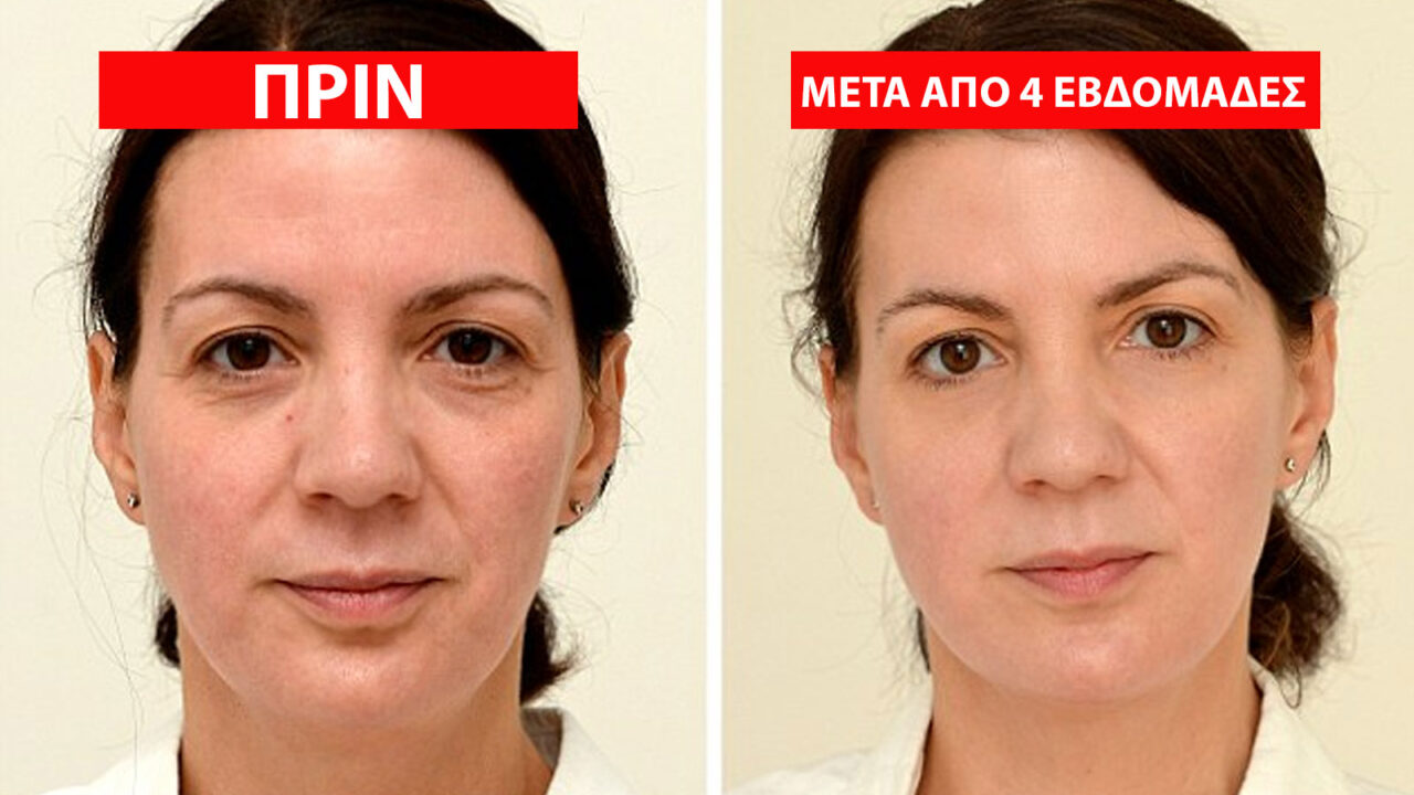 οφέλη νερού,συμβουλές ομορφιάς,ομορφιά,φροντίδα προσώπου,νερό και επιδερμίδα,