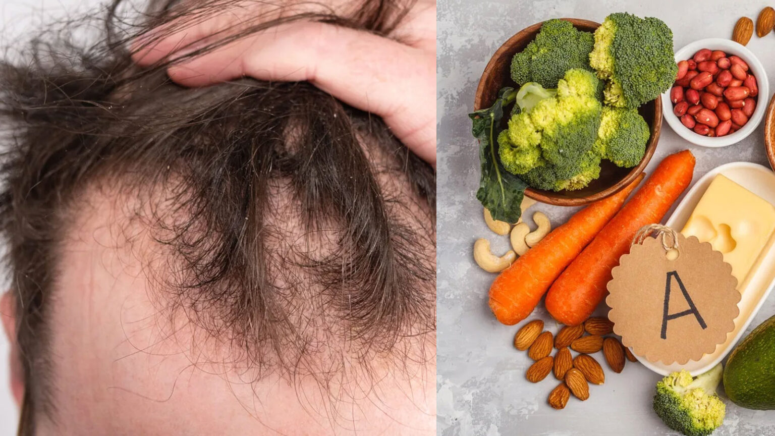 ΑΠΩΛΕΙΑ ΜΑΛΛΙΩΝ: 7 Βιταμίνες που Μπορούν να Βοηθήσουν στην Αντιμετώπιση της Τριχόπτωσης