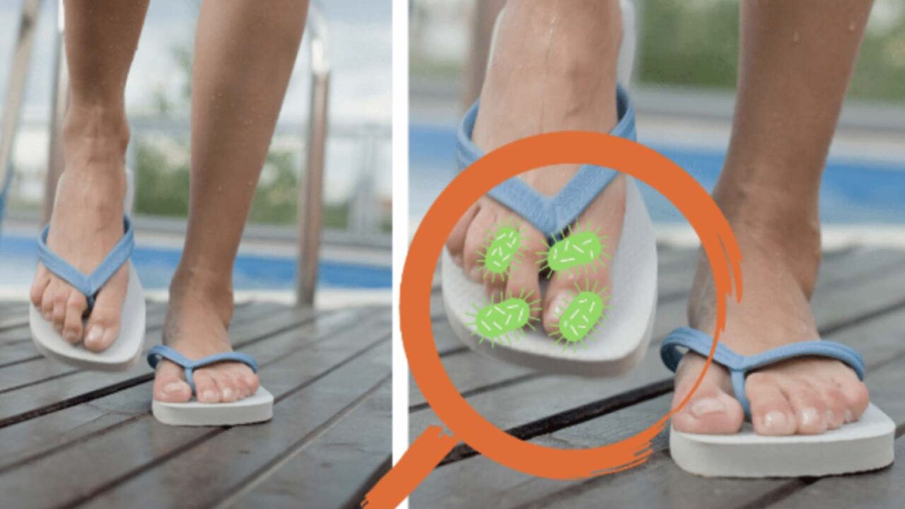 Γιατί το να ΜΗΝ Φοράτε Σαγιονάρες Μπορεί να Είναι Ευεργετικό για την Υγεία σας