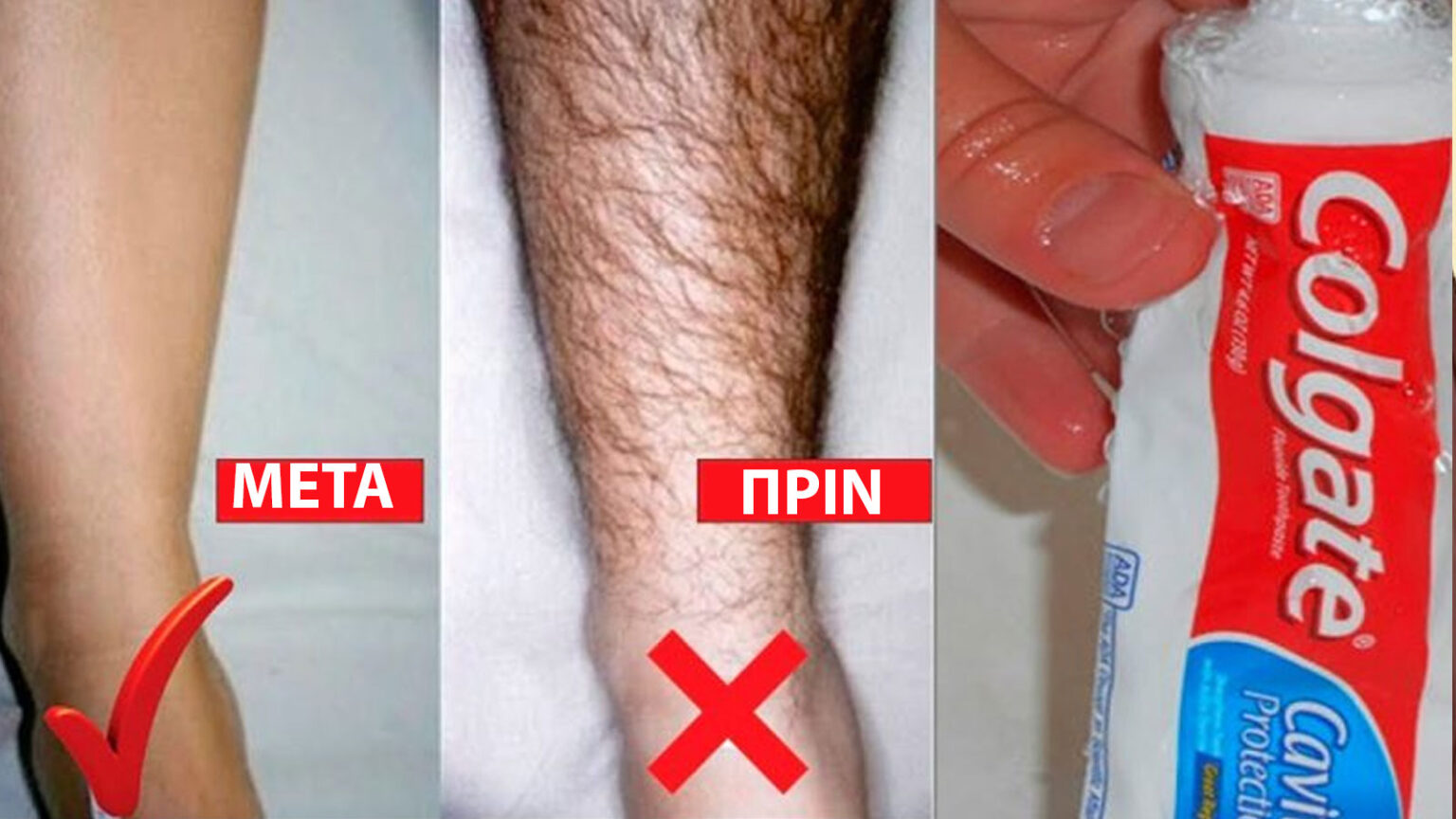 αποτρίχωση με οδοντόκρεμα,μόνιμη αποτρίχωση,αποτρίχωση στο σπίτι,συμβουλές ομορφιάς,ομορφιά,