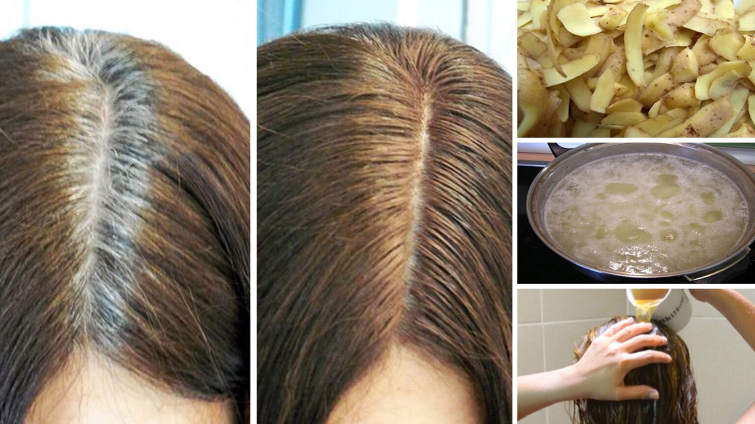 Γκρίζα Μαλλιά Και Φλούδα Πατάτας: Αυτό το Μαύρο Νερό Θα Τα Εξαφανίσει Για Πάντα