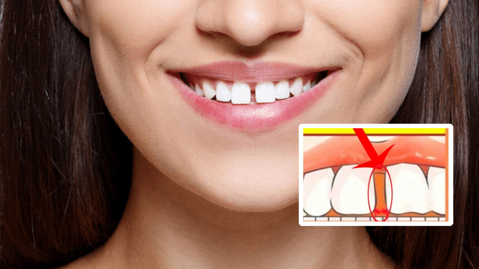 κενό ανάμεσα στα δόντια,καλοτυχία,κακοτυχία,περίεργα,χρήσιμα,