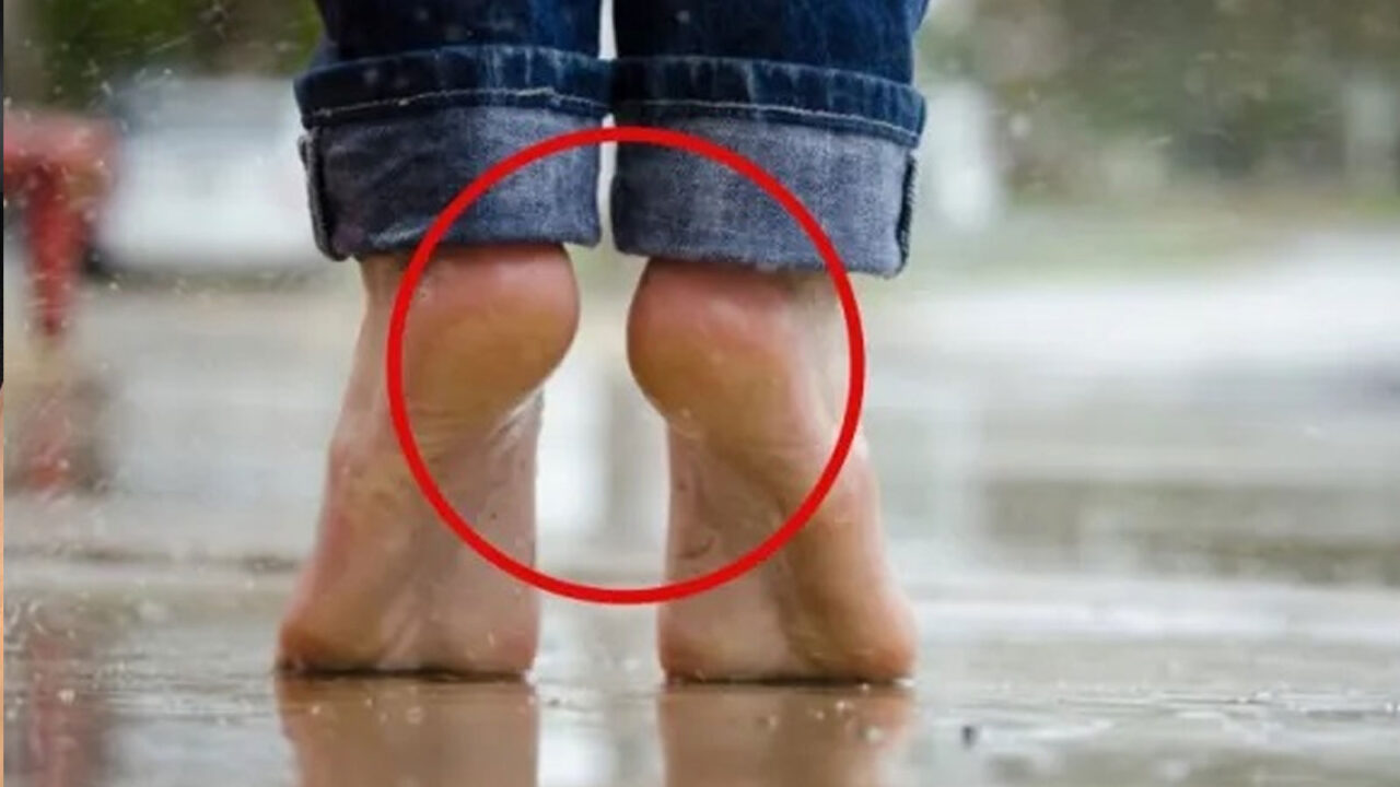 κίτρινες πατούσες,αντιμετώπιση κίτρινων πατουσών,φροντίδα πατουσών,ομορφιά,συμβουλές ομορφιάς,υγεία,συμβουλές υγείας,