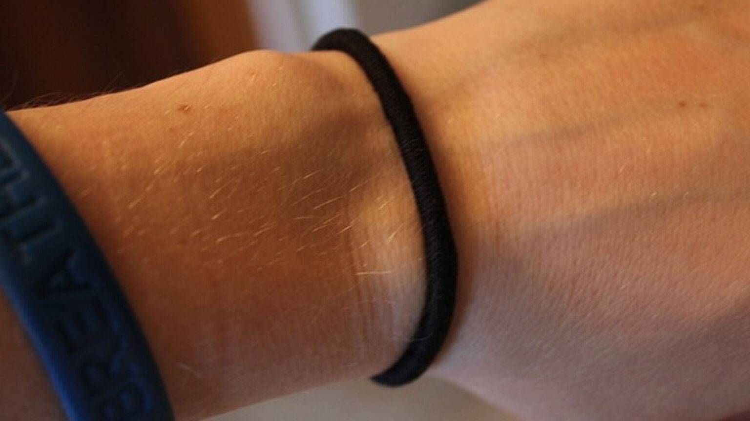 κίνδυνος από λαστιχάκι μαλλιών,συμβουλές υγείας,υγεία,χρήσιμα,