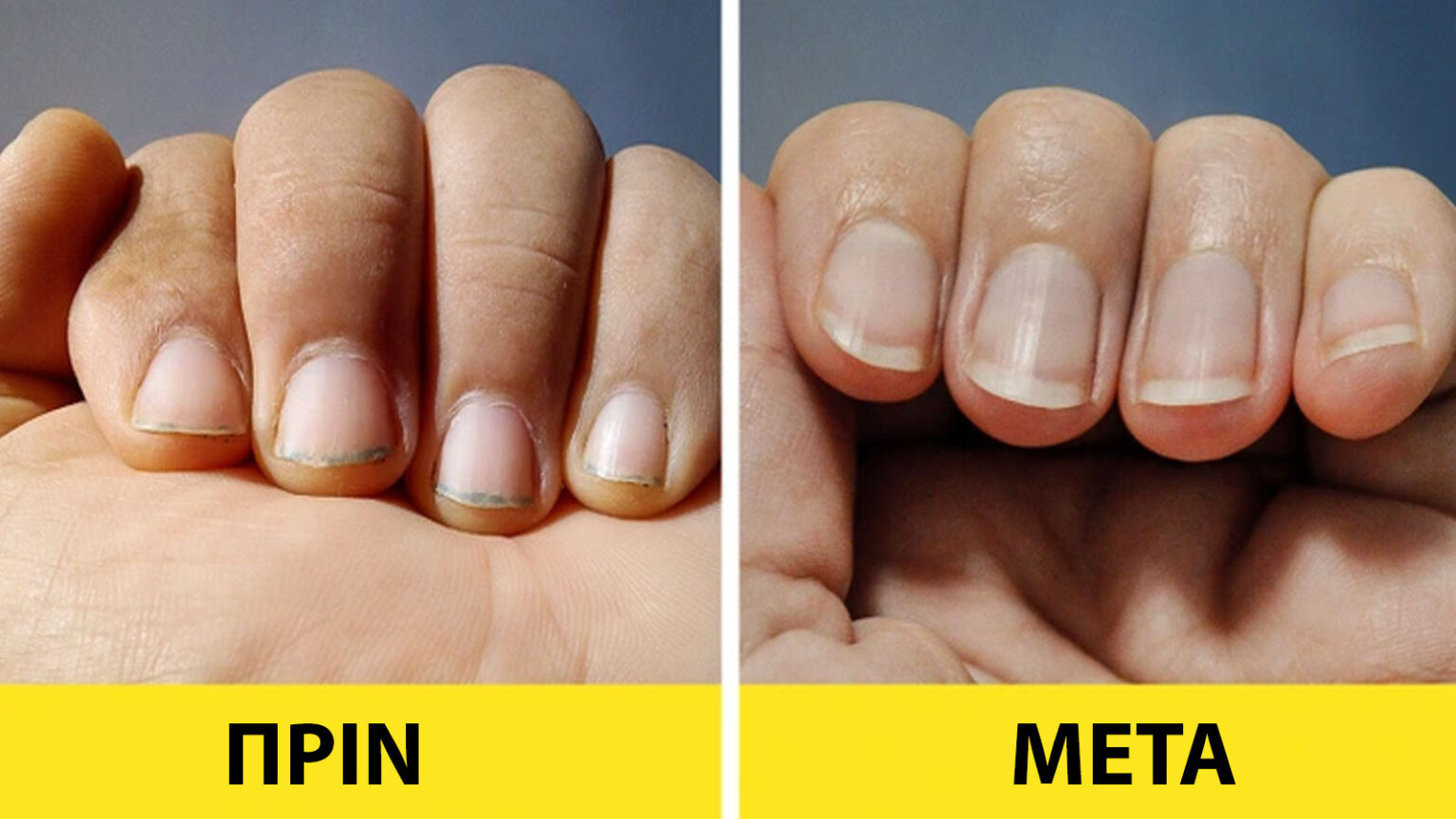 Ληγμένα Προϊόντα: 7 Χρήσιμοι τρόποι να τα χρησιμοποιήσετε αντί να τα πετάξετε