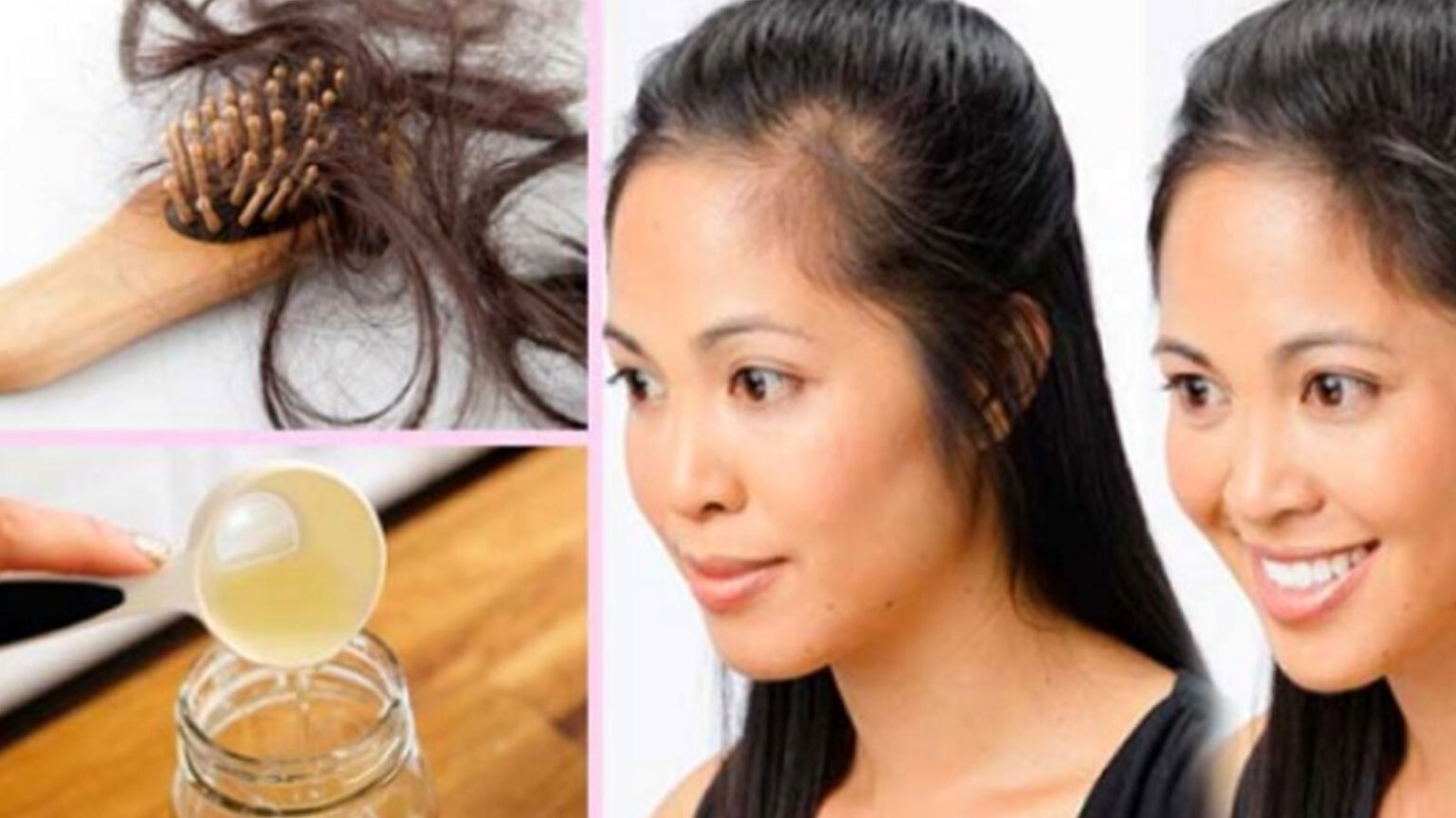 τριχόπτωση,αντιμετώπιση τριχόπτωσης,σπιτικό σαμπουάν τριχόπτωσης,φροντίδα μαλλιών,συμβουλές ομορφιάς,ομορφιά,