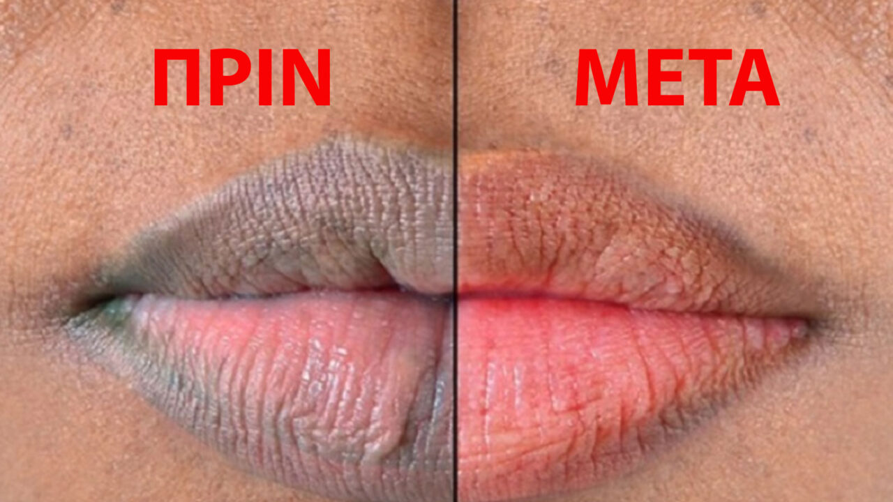 σκούρα χείλη,λεύκανση σκούρων χειλιών,φροντίδα χειλιών,συμβουλές ομορφιάς,ομορφιά,