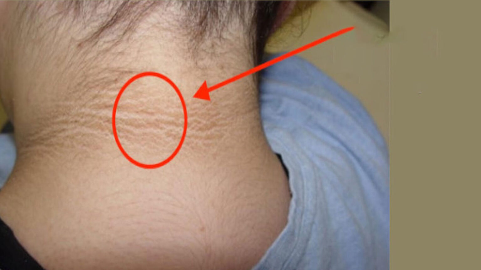 σκούρος λαιμός,αντιμετώπιση σκούρου λαιμού,φροντίδα λαιμού,σπιτικές θεραπείες ομορφιάς,συμβουλές ομορφιάς,ομορφιά,