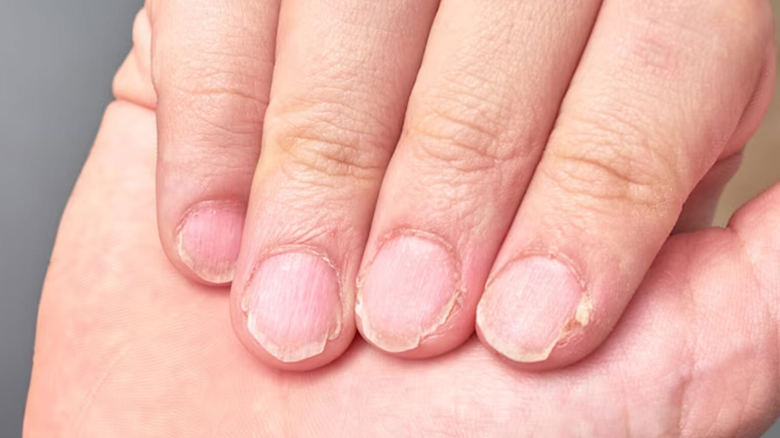 Εύθραυστα & Αδύναμα Νύχια: 7 Εύκολοι Φυσικοί Τρόποι για να Κάνετε τα πιο Δυνατά