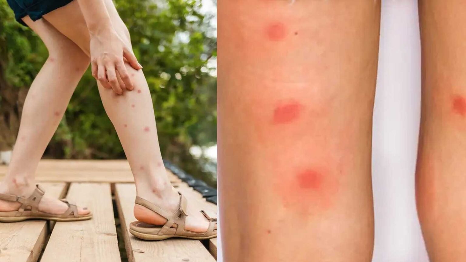 Δεν έχεις Κοριούς Νομίζεις ότι έχεις: 10 Σημάδια να δεις την πραγματικότητα