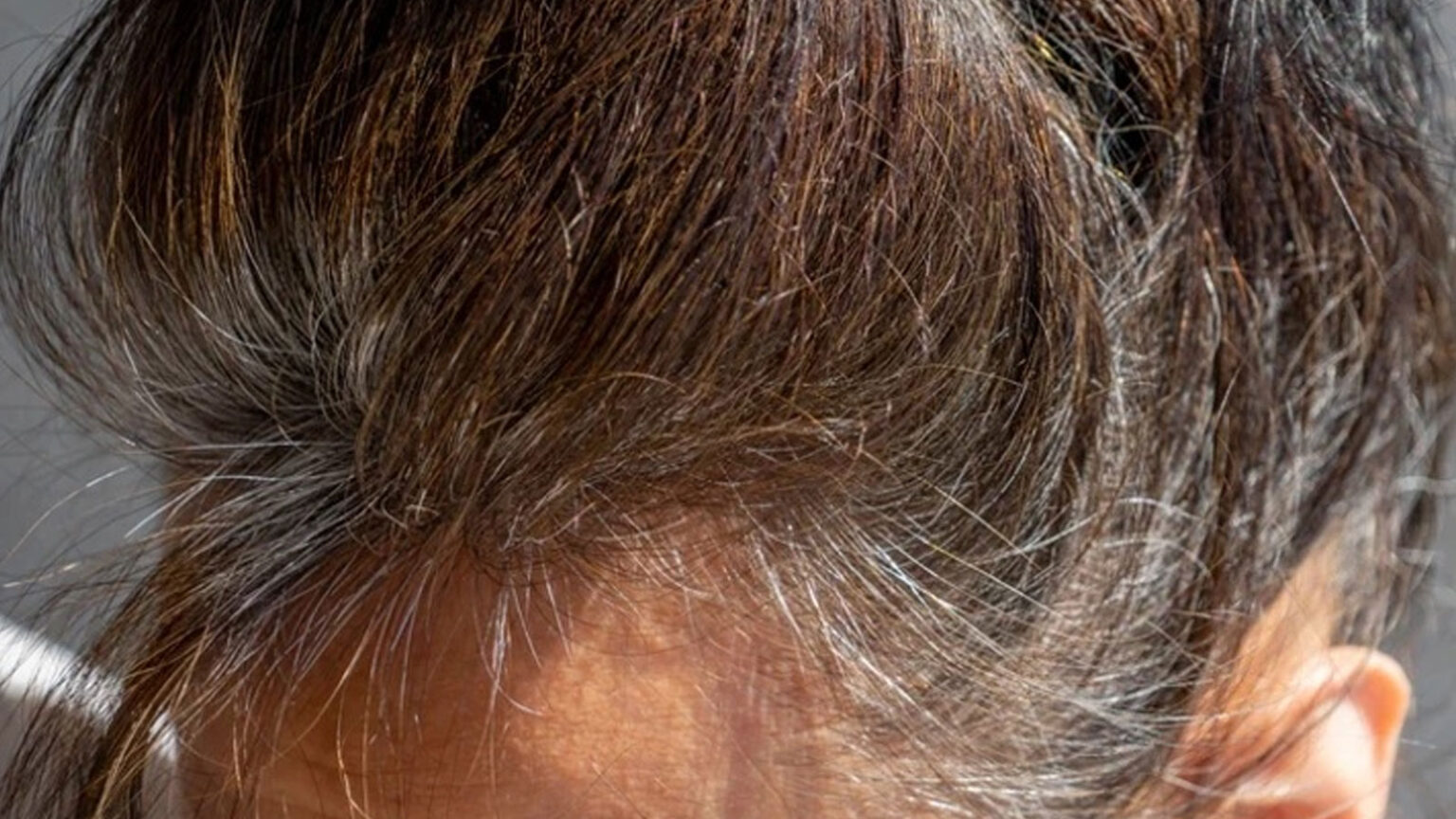 Πρόωρο Γκριζάρισμα Των Μαλλιών: Πώς Μπορεί να Επιβραδυνθεί και μια Βιταμίνη που Μπορεί να Βοηθήσει