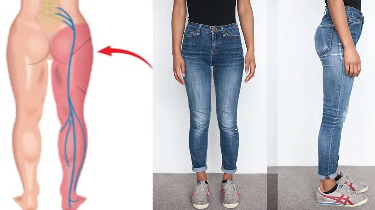 Σταμάτα να φοράς στενά παντελόνια πολύ συχνά - Δες τα προβλήματα που προκαλεί στο σώμα και τον οργανισμό σου