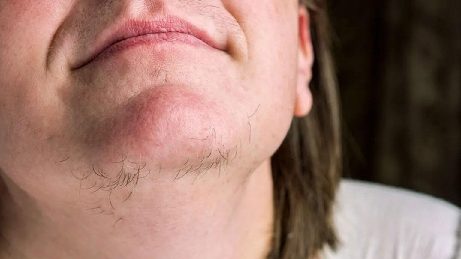 Τριχοφυΐα στο πρόσωπο: Ο έξυπνος φυσικός τρόπος για πεντακάθαρη επιδερμίδα