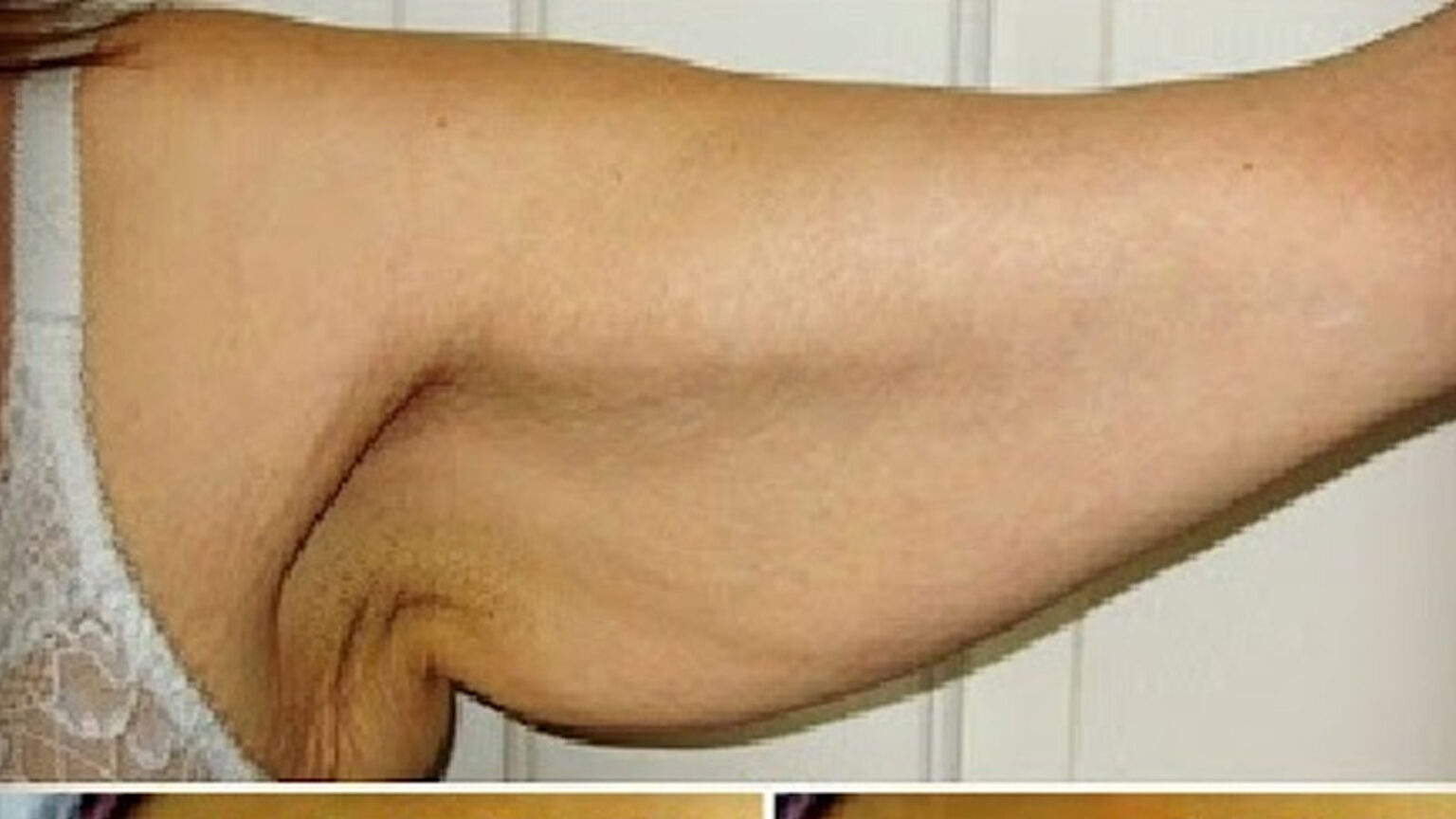 DIY Φυσική Κρέμα για τις Ραγάδες και το Χαλαρό Δέρμα