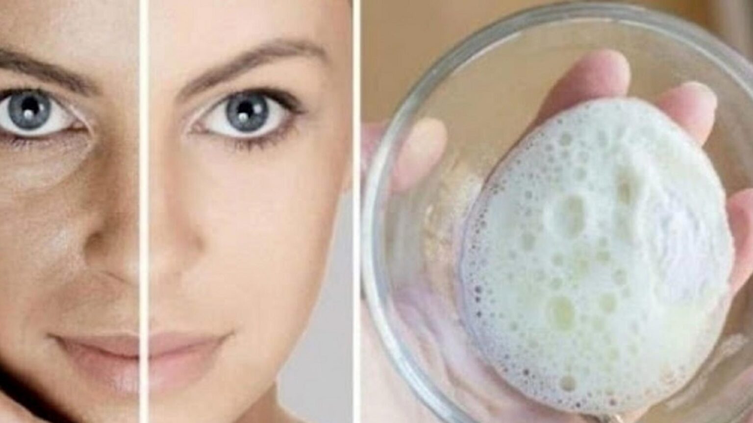 Ρυτίδες, Καφέ Κηλίδες και Μαύρα Στίγματα: Πως να Φτιάξετε Κρέμα με Μαγειρική Σόδα που Τις Αφαιρεί