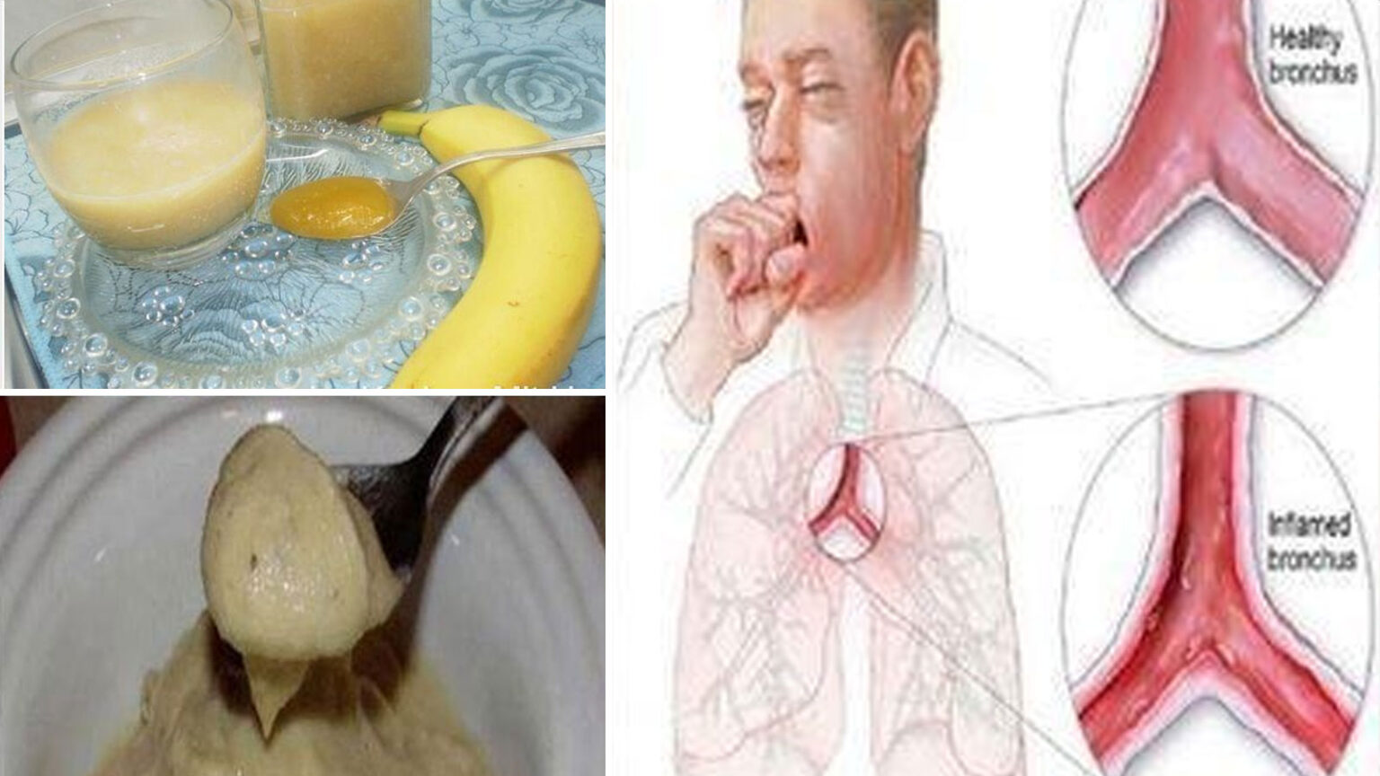 Φτιάξε αυτό το ρόφημα με μπανάνα μέλι και νερό: Για πονόλαιμο, έντονο βήχα, ακόμα και για το στομάχι - Έτοιμο σε 5 Λεπτά