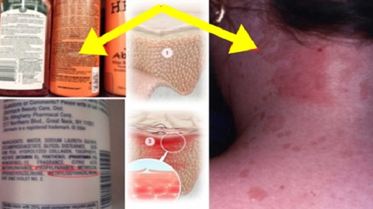 Σαμπουάν με Τοξικά Συστατικά: Μην Αγοράζετε Ποτέ Σαμπουάν που Περιέχουν Αυτά τα 6 Στοιχεία