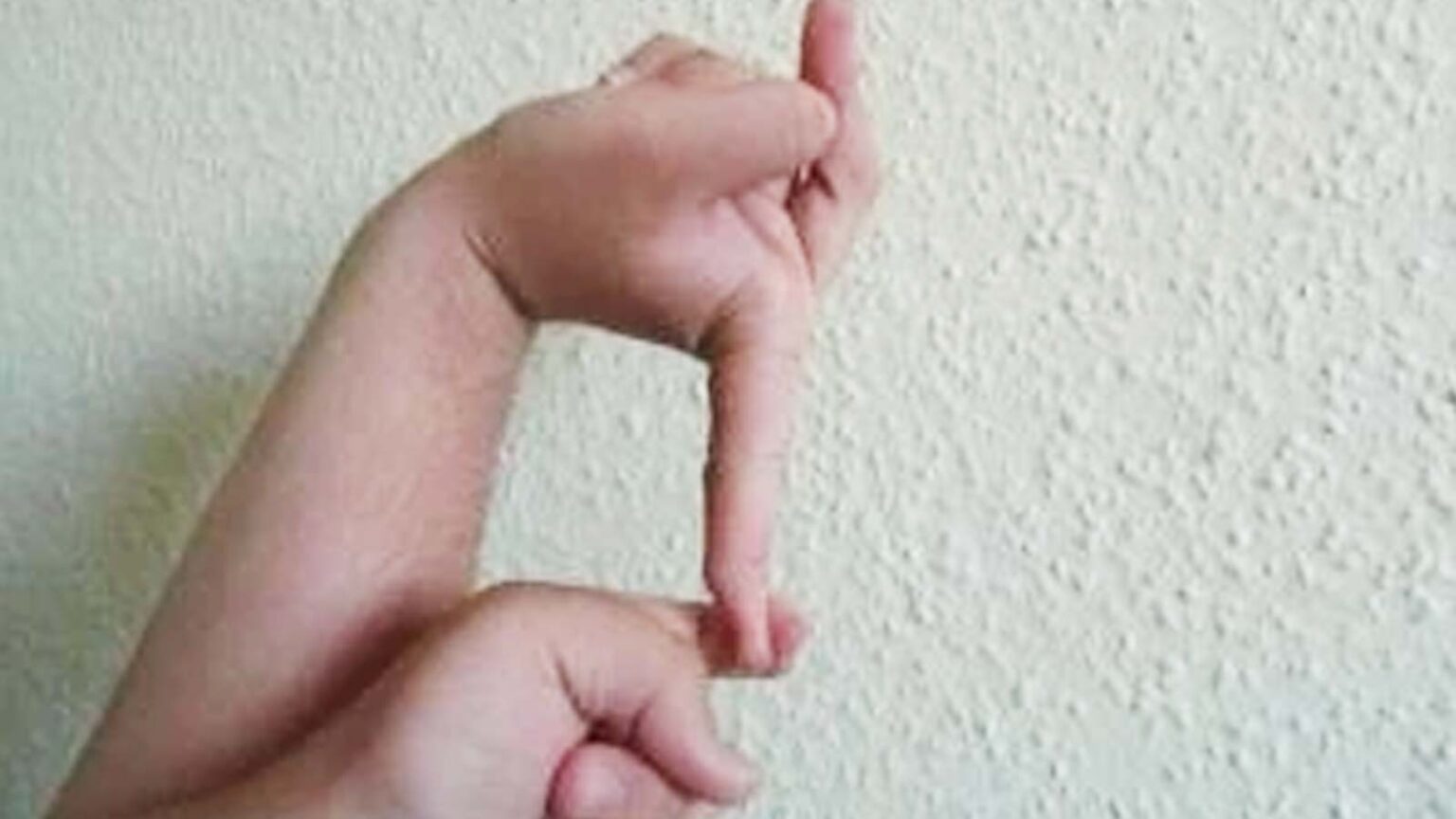 Οι 8 πιο παράξενες παθήσεις που δεν ξέραμε ότι υπάρχουν