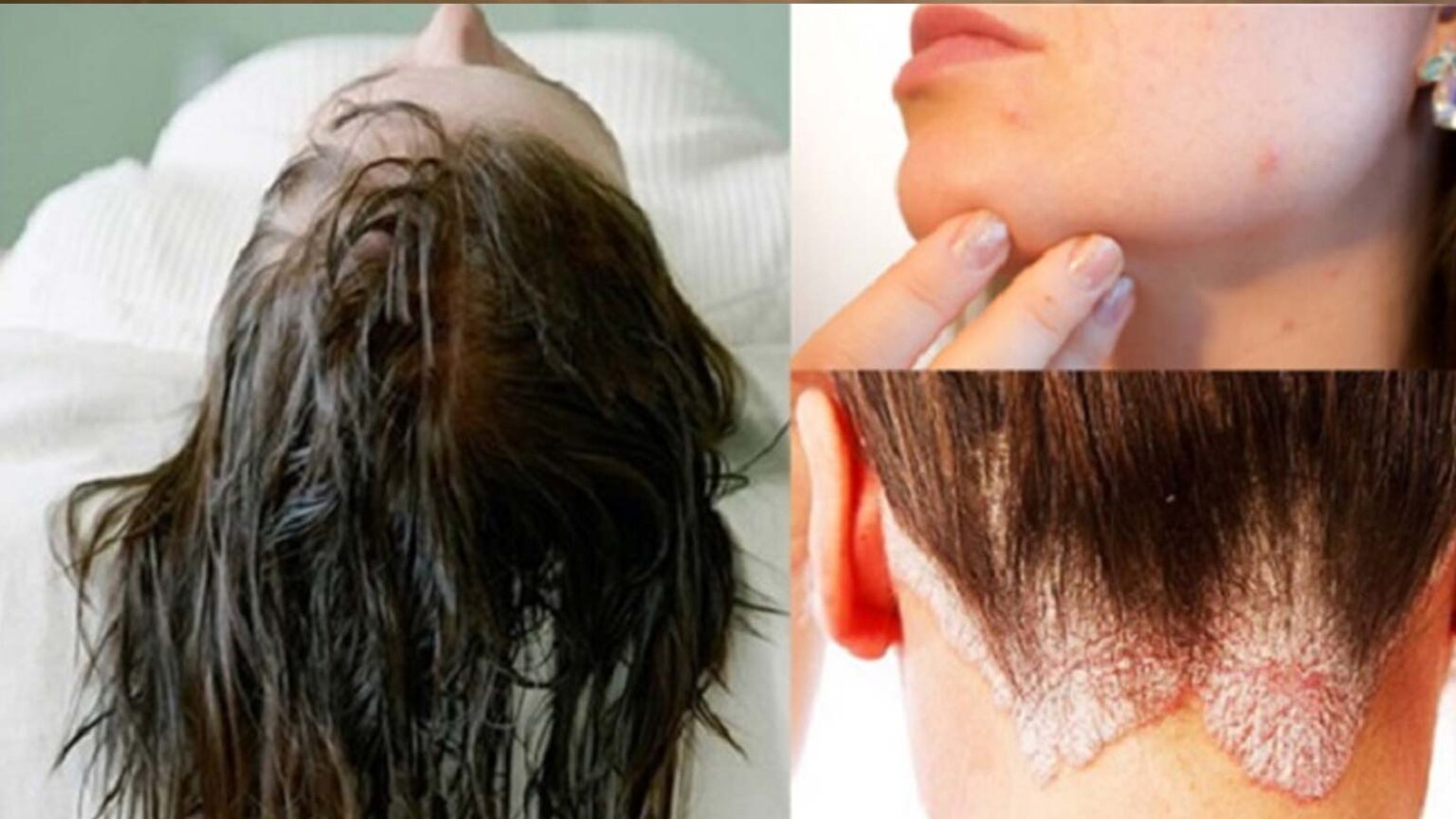 Ύπνος με βρεγμένα μαλλιά: 7 Επιπτώσεις που σίγουρα θα σας κάνει να σταματήστε να το κάνετε τώρα!