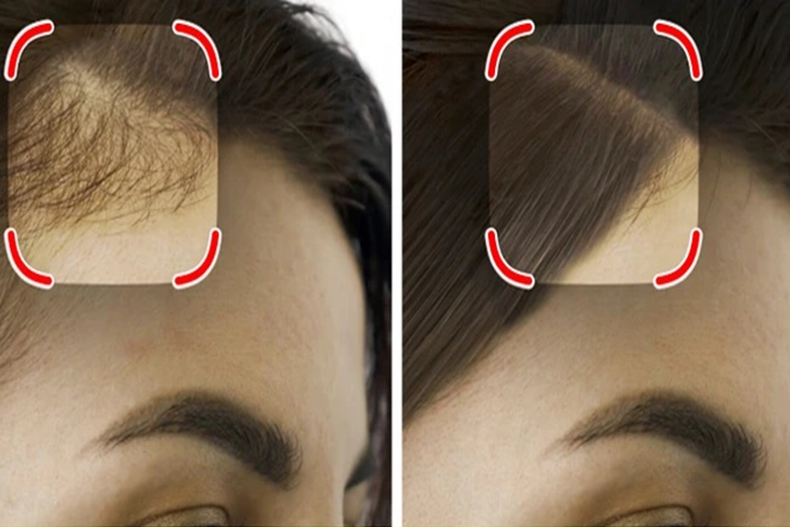 Έλλειψη Βιταμίνης D: 7 Κρίσιμα Σημάδια και οι Επιπτώσεις Στον Οργανισμό