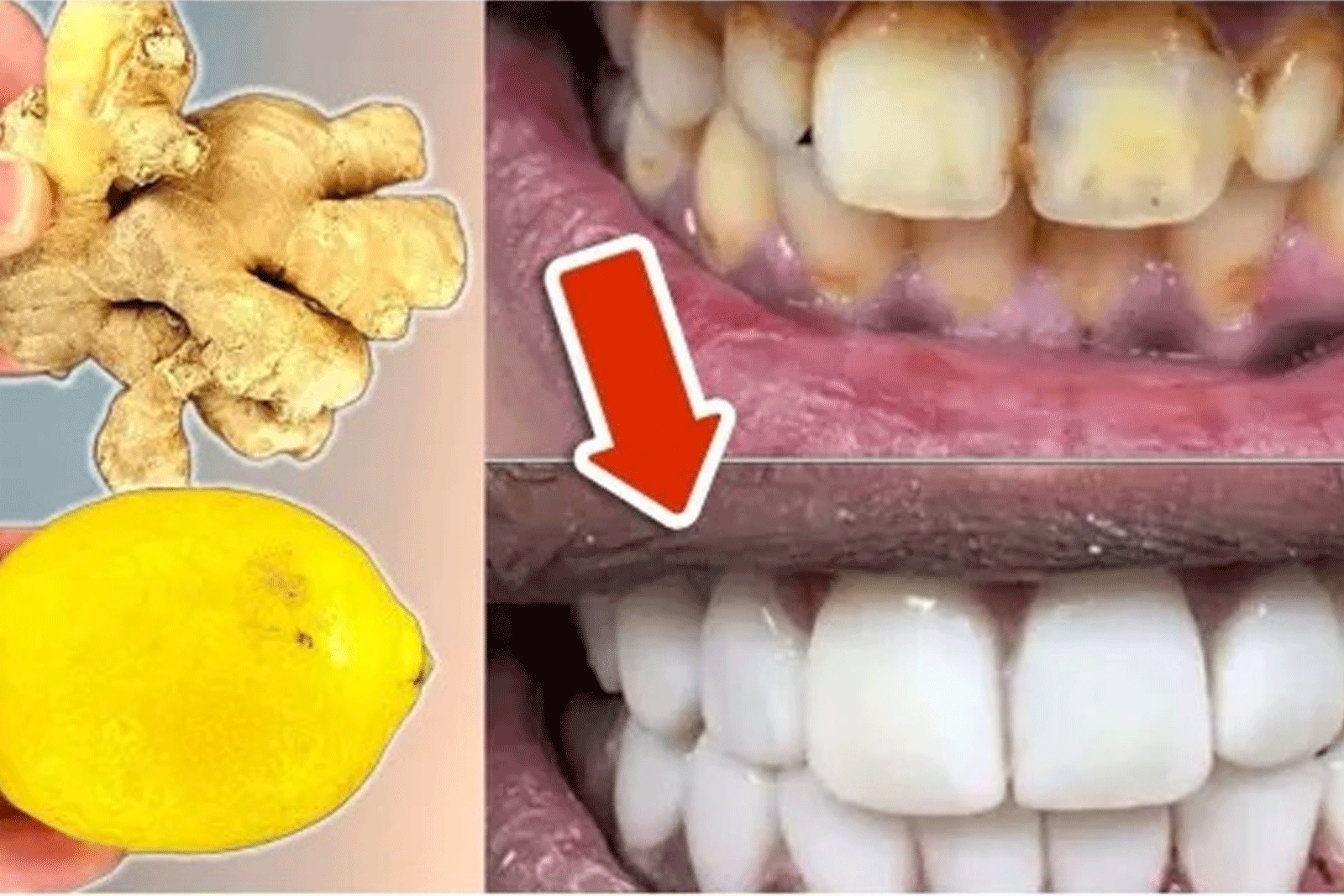 Αποτελεσματική Φυσική Θεραπεία για Λευκά Δόντια στο Σπίτι
