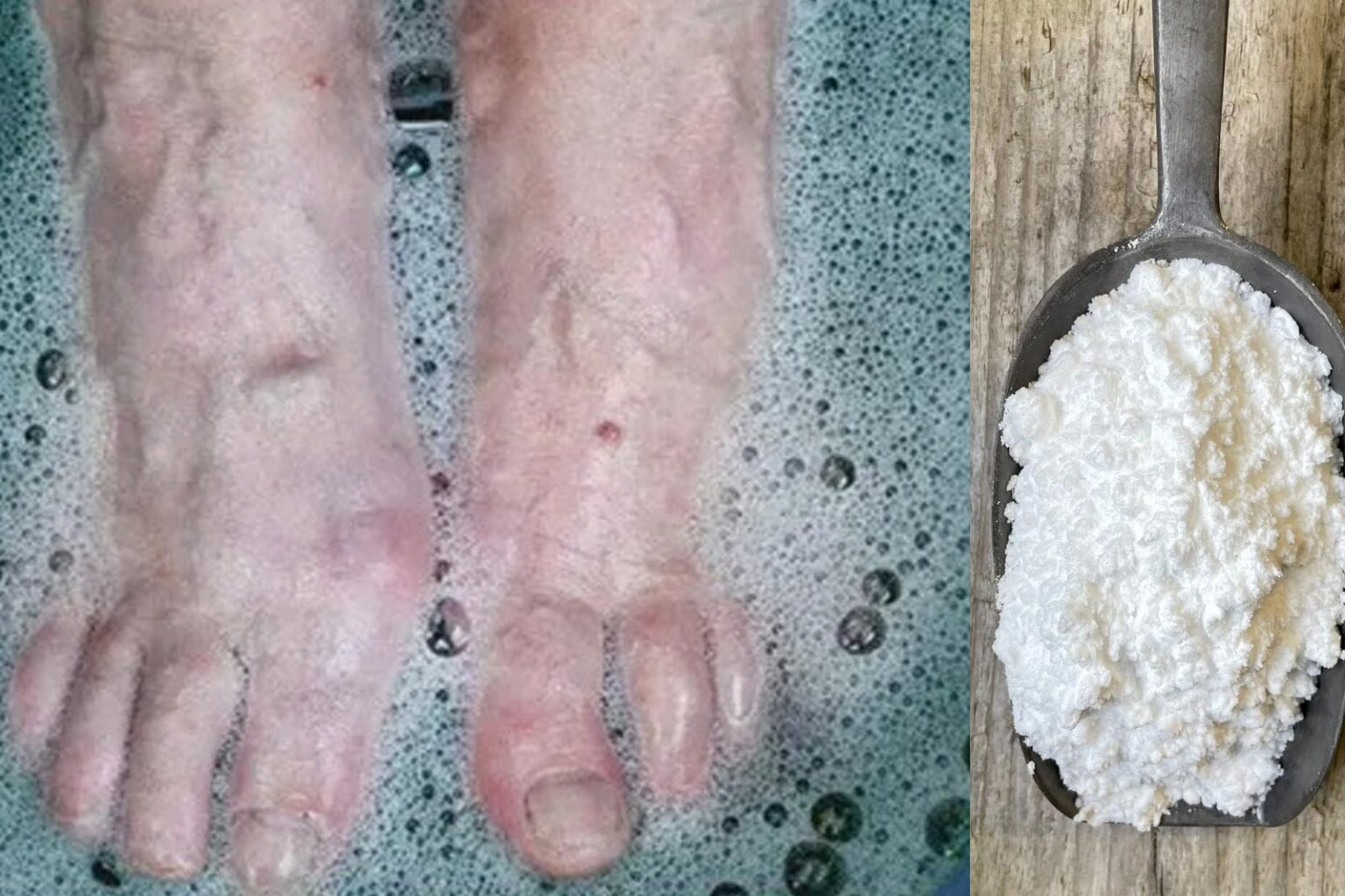 Ανακουφίστε τον Πόνο στις Φτέρνες σας με Μαγειρική Σόδα - Η φυσική λύση