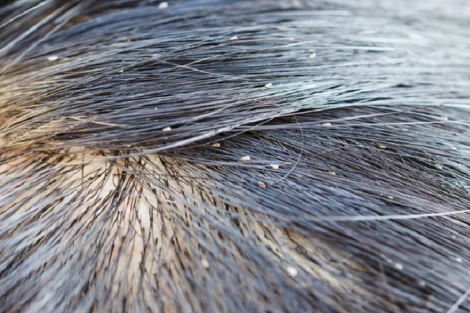 Ψείρες στα Μαλλιά: Πώς να Κρατήσετε τις Ψείρες Μακριά από το Κεφάλι των Παιδιών σας